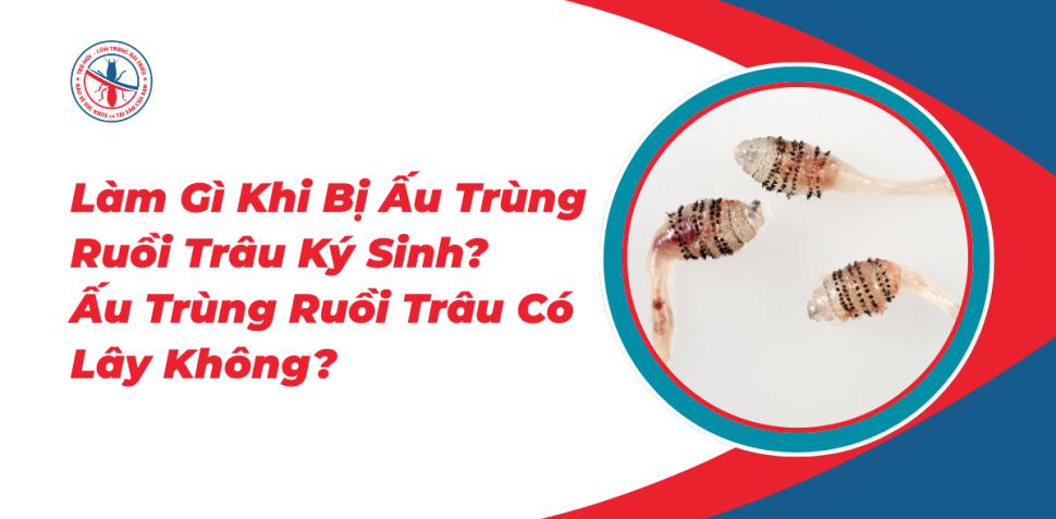 Lam-Gi-Khi-Bi-Au-Trung-Ruoi-Trau-Ky-Sinh-Au-Trung-Ruoi-Trau-Co-Lay-Khong